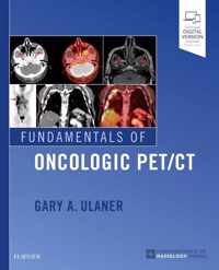 Fundamentals of Oncologic PET/CT