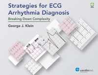 Strategies for ECG Arrhythmia Diagnosis