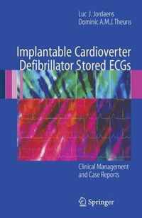 Implantable Cardioverter Defibrillator Stored ECGs