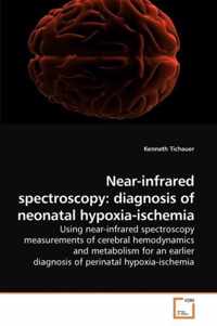 Near-infrared spectroscopy