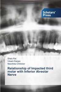 Relationship of Impacted third molar with Inferior Alveolar Nerve