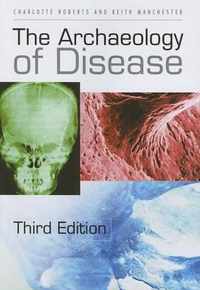 The Archaeology of Disease