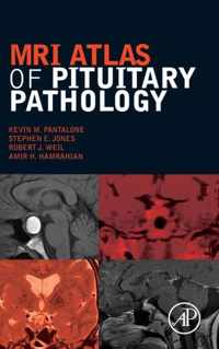 MRI Atlas of Pituitary Pathology