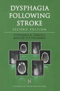 Dysphagia Following Stroke