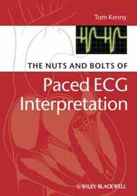 The Nuts and bolts of Paced ECG Interpretation