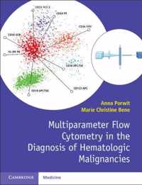 Multiparameter Flow Cytometry in the Diagnosis of Hematologic Malignancies