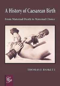 History of Caesarean Birth