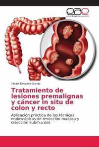 Tratamiento de lesiones premalignas y cancer in situ de colon y recto