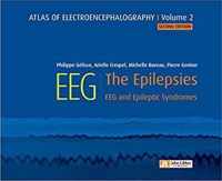 Atlas of Electroencephalography -- Volume 2