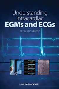 Understanding Intracardiac EGMs and ECGs