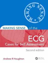 Making Sense of the ECG