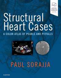 Structural Heart Cases