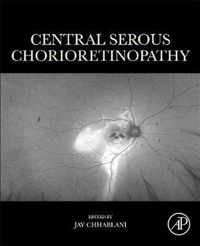 Central Serous Chorioretinopathy