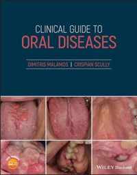 Clinical Guide to Oral Diseases