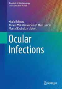 Ocular Infections