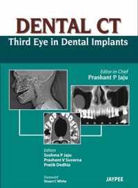 Dental CT Third Eye in Dental Implants