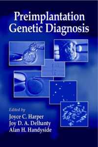 Preimplantation Genetic Diagnosis