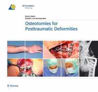 Osteotomies for Posttraumatic Deformities