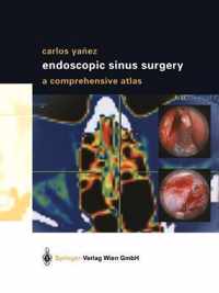 Endoscopic Sinus Surgery