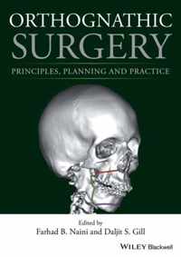 Orthognathic Surgery Principles Planning