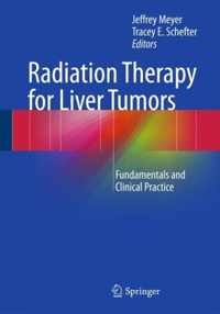 Radiation Therapy for Liver Tumors