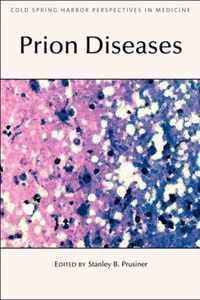 Prion Diseases