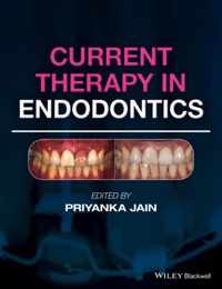 Current Therapy in Endodontics