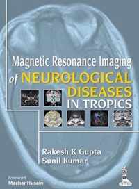 Magnetic Resonance Imaging of Neurological Diseases in Tropics