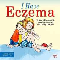 I Have Eczema