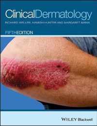 Clinical Dermatology