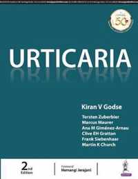 Urticaria