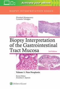 Biopsy Interpretation of the Gastrointestinal Tract Mucosa: Volume 1