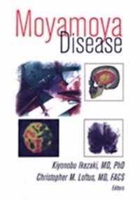 Moyamoya Disease