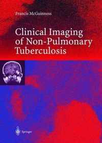 Clinical Imaging in Non-pulmonary Tuberculosis