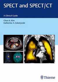 SPECT and SPECT/CT