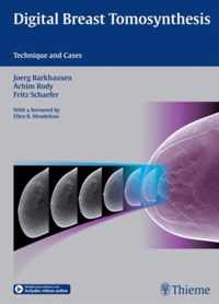 Digital Breast Tomosynthesis