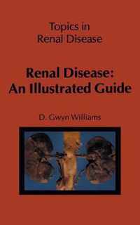 Renal Disease