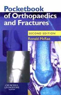 Pocketbook of Orthopaedics and Fractures