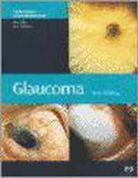 Glaucoma