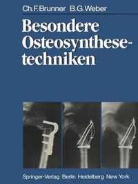 Besondere Osteosynthesetechniken