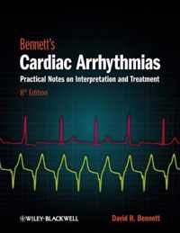 Bennetts Cardiac Arrhythmias