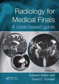 Radiology for Medical Finals