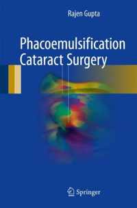 Phacoemulsification Cataract Surgery