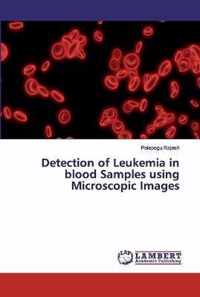 Detection of Leukemia in blood Samples using Microscopic Images