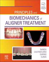 Principles and Biomechanics of Aligner Treatment