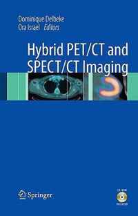 Hybrid Pet/Ct And Spect/Ct Imaging