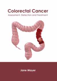 Colorectal Cancer