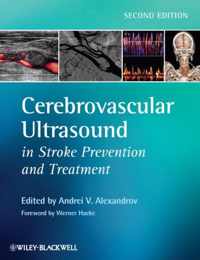 Cerebrovascular Ultrasound In Stroke Prevention And Treatmen