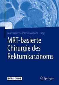 Mrt-Basierte Chirurgie Des Rektumkarzinoms