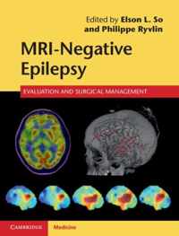 Mri Negative Epilepsy